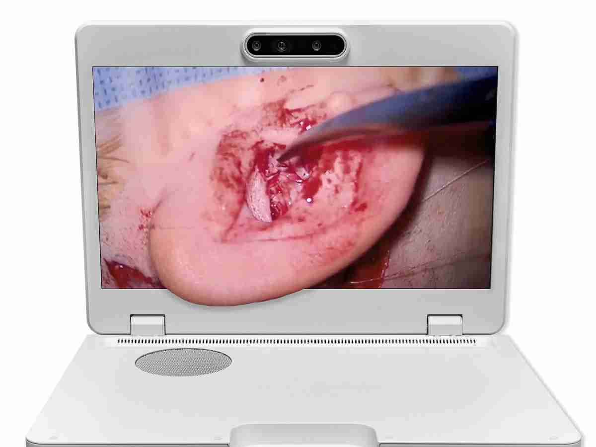 达擎之＂Heads-up 3D显微手术显示系统＂，，，，整合4K裸眼3D显示及眼球追踪系统，，，，具备快速追踪人眼移动位置功能，，，，减轻医师长时间维持固定姿势的负担，，让医师能有更宽广清晰的3D立体视野及更舒适的姿势来执行手术。。